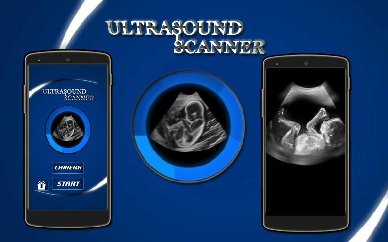 Ultrasound Scanner (Prank)