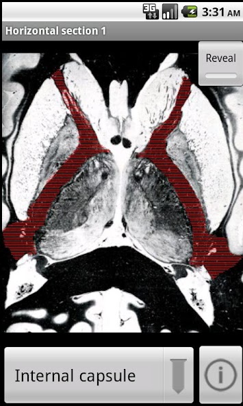 NeuroSlice