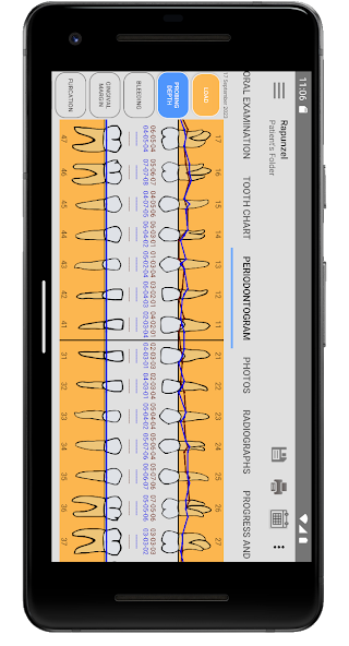 Cusp Dental Software