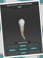 CavSim : Dental Cavity Trial