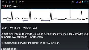 EKG Lernen