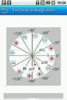 Electrocardiograma