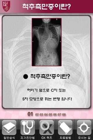 Korea University Scoliosis