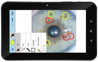 IRIDOLOGIA IRIS SMART 2.0