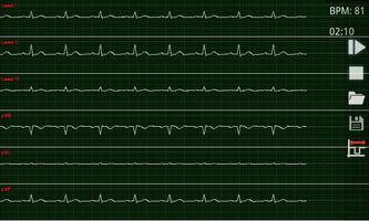 ABI-ECG