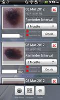 Doctor Mole - Skin cancer app