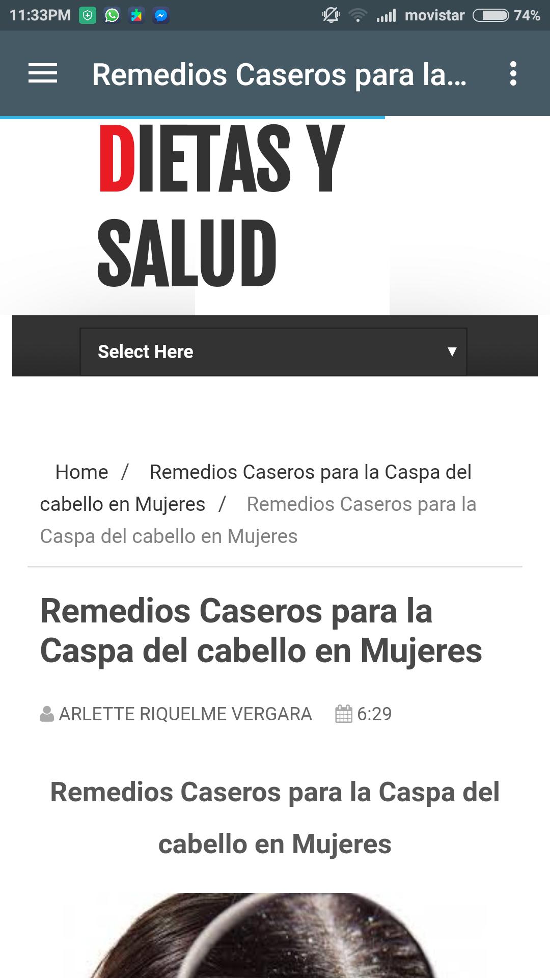 Remedios Caseros para Caspa