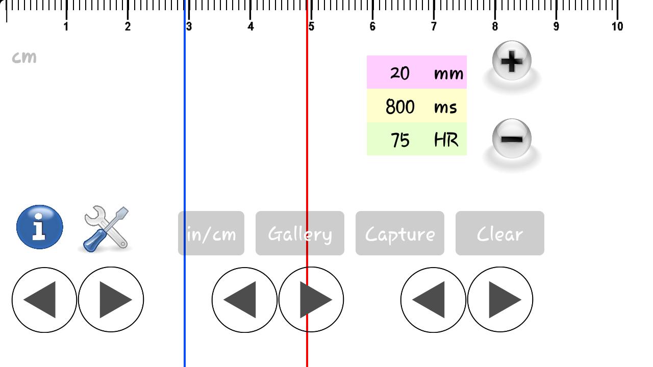ECG Caliper Demo
