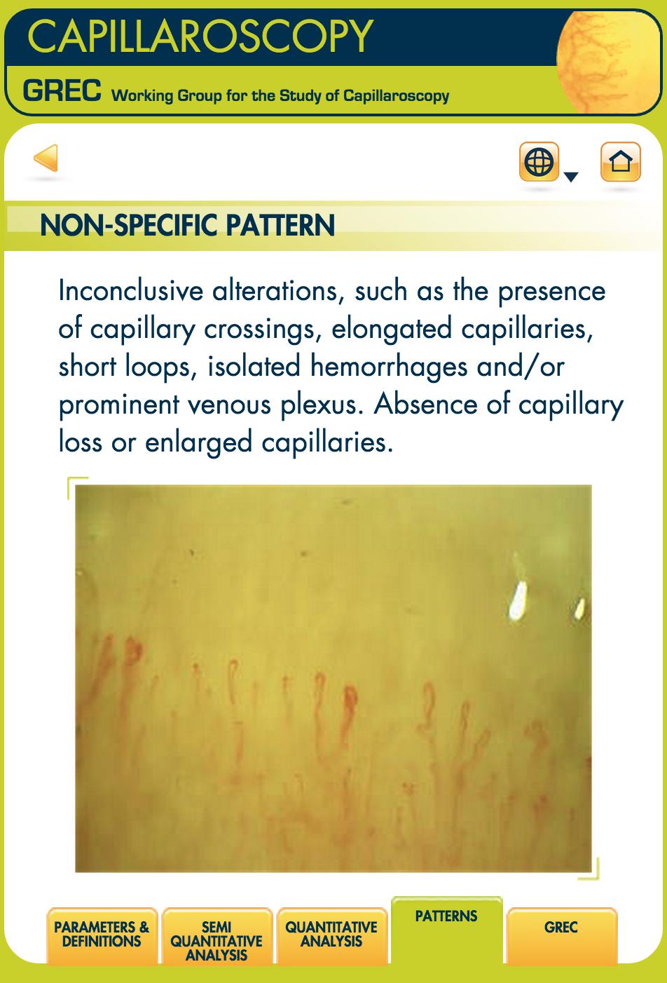 Capillaroscopy