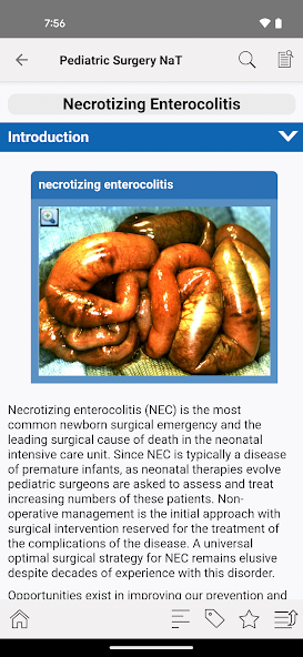 APSA Pediatric Surgery Library