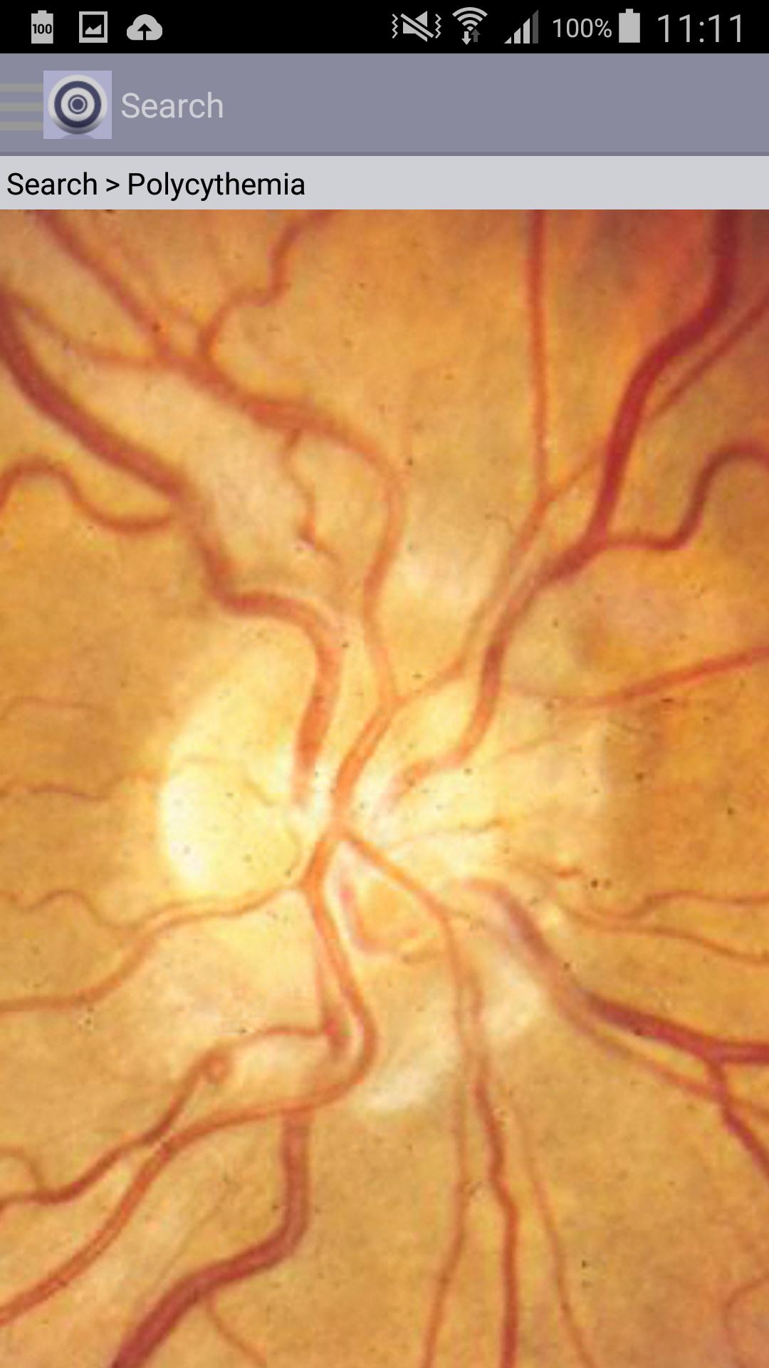 Atlas of Ophthalmology Onjoph