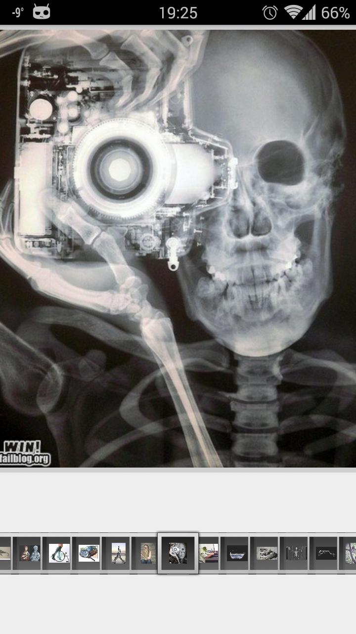 Super Funny X-Ray