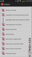 Heart Defects