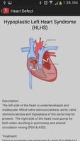 Heart Defects