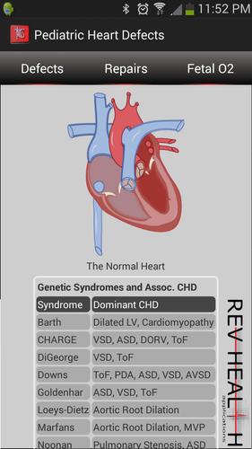 Heart Defects