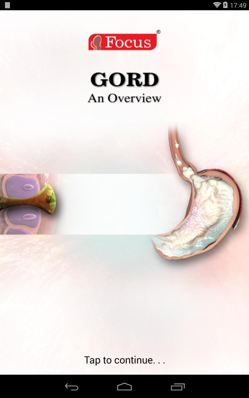 GORD / GERD - An Overview