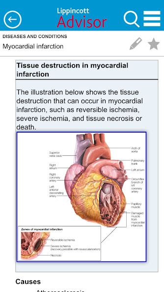 Lippincott Nursing Advisor