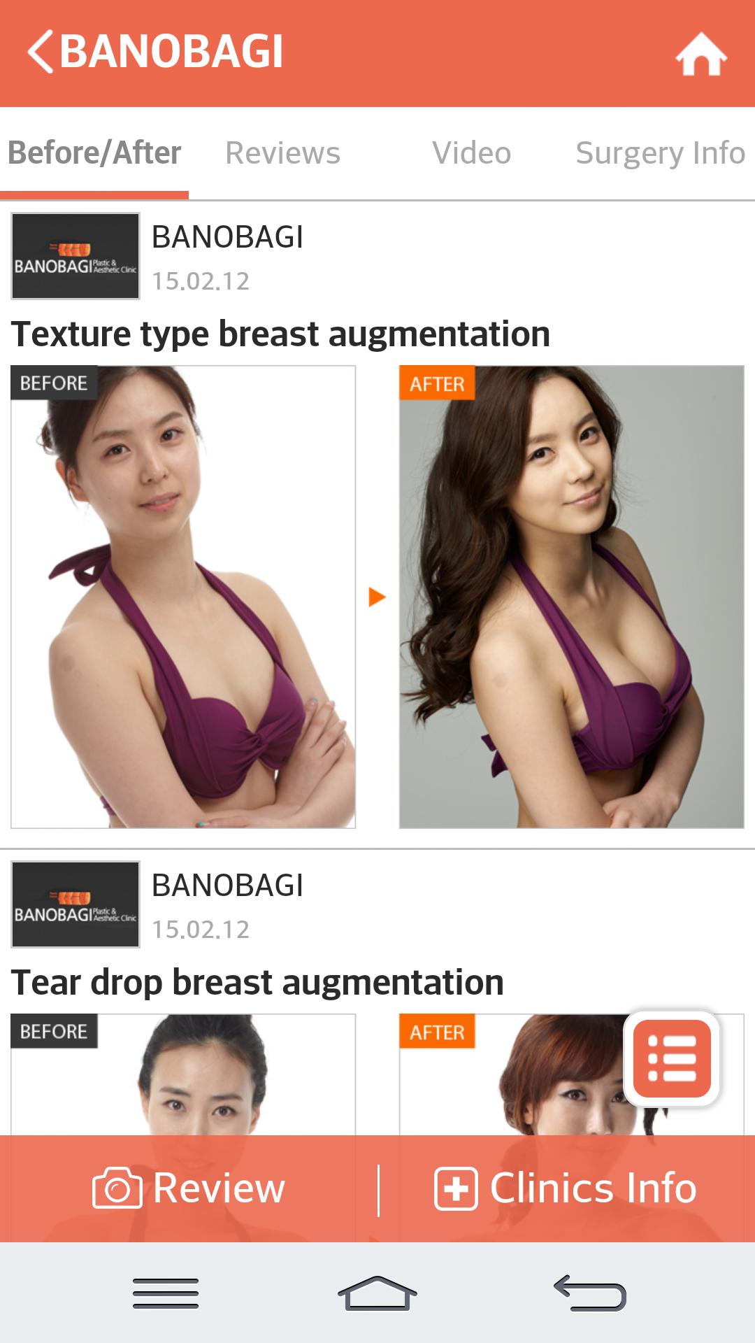 Gangnam Beauty-Plastic surgery