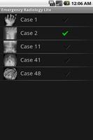 Emergency Radiology Lite