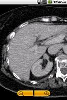 Emergency Radiology Lite
