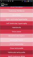 Ecg Interpretation